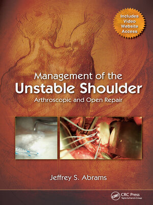 cover image of Management of the Unstable Shoulder